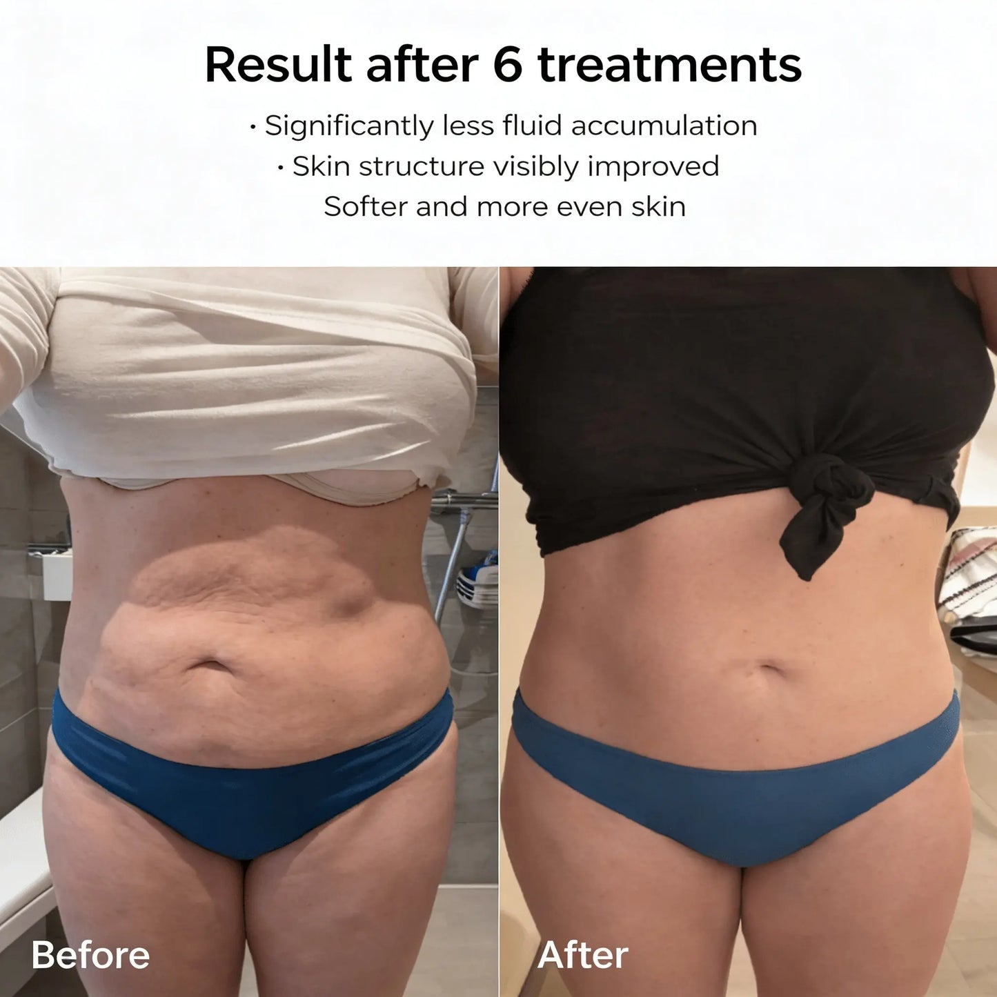 Celluviaa – Smooth Skin in 14 Days