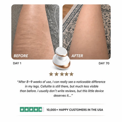 Celluviaa – Smooth Skin in 14 Days